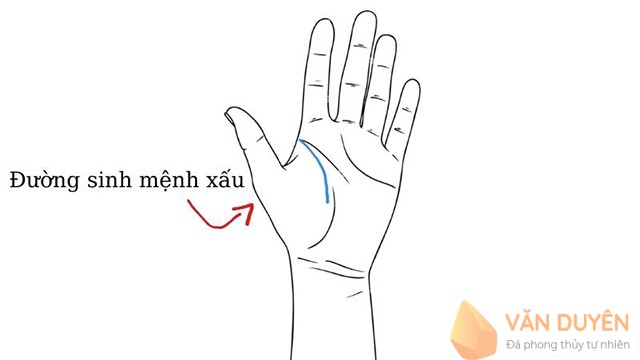 Đường chỉ tay sinh đạo xấu là đường nông, ngắn, không rõ ràng